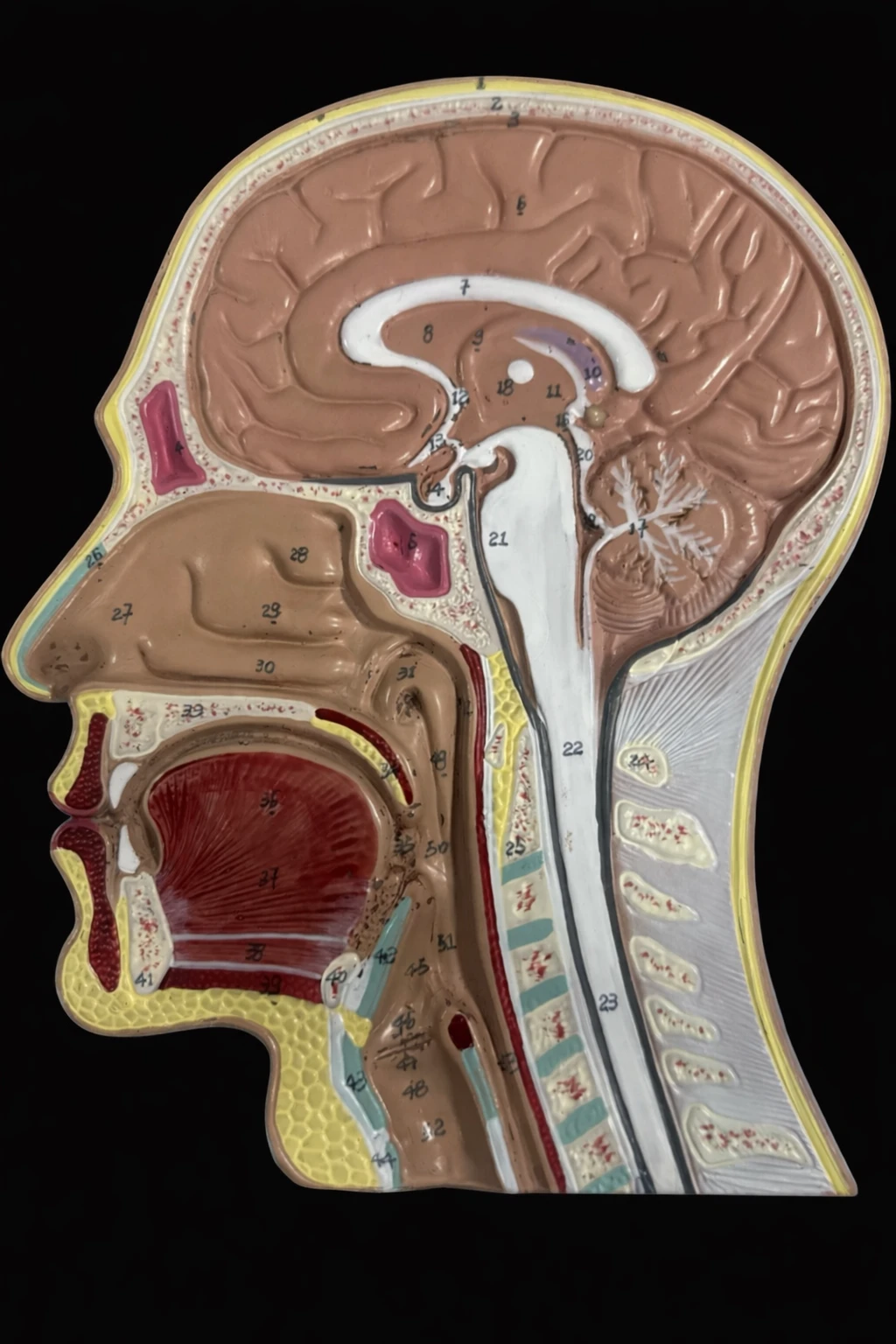 NeuroAnatomia - Diencefalo