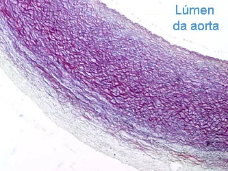 elasticas