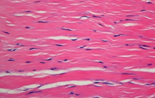 ligamento