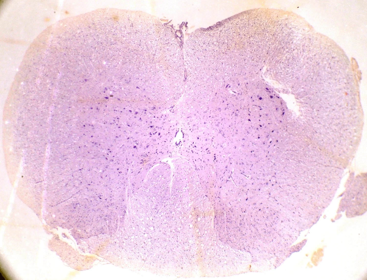 SISTEMA NERVOSO CENTRAL